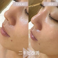 ブログ