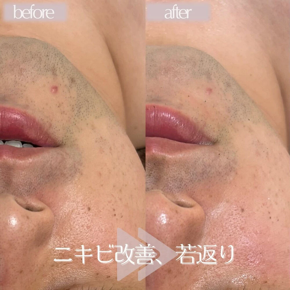 ブログ
